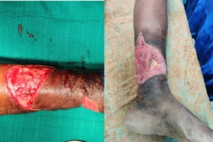 Orthopaedics & Plastic Surgery